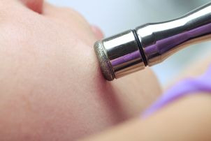 Zabieg mikrodermabrazji