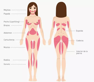 Gdzie można wykonać liposukcję