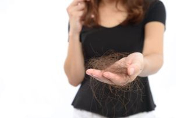 Przyczyny łysienia