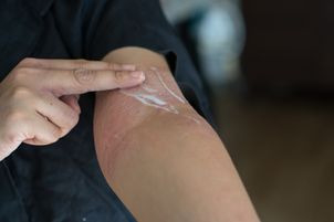 Leczenie kortykosteroidami