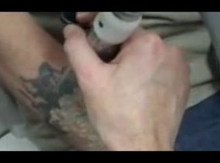 Usuwanie tatuaży