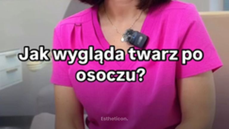 osocze