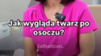 osocze
