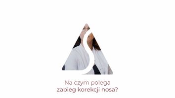 Korekta nosa - Dr Zofia Bochen