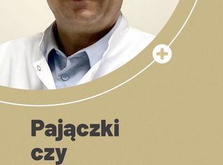 Pajączki czy żylaki