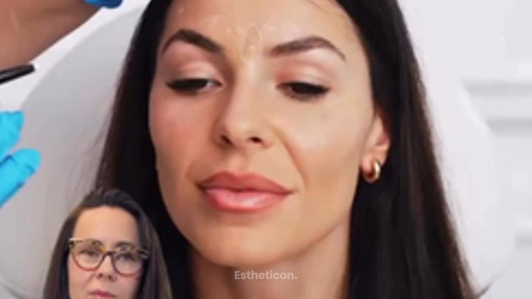 botulina
