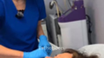 Osocze bogatopłytkowe dla pięknej skóry: Czy to rozwiązanie dla Ciebie?