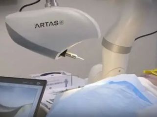 Zaawansowana technologia przeszczepu włosów - ARTASiX