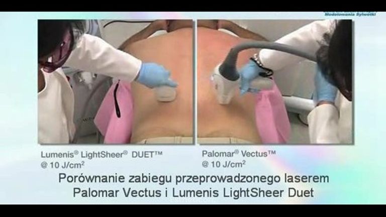 Vectus - inteligentna depilacja laserowa 