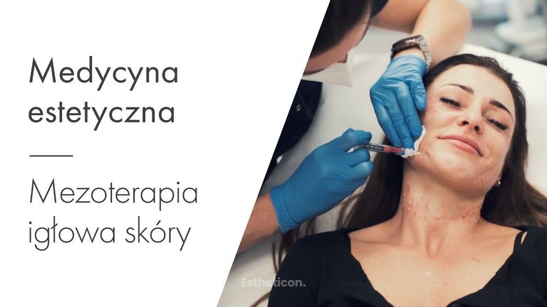 Mezoterapia igłowa skóry twarzy (Sabina Derda)