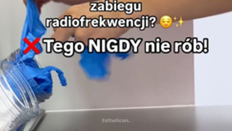 radiofrekwencja