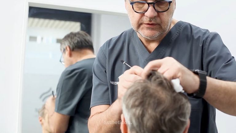 Przeszczep włosów Artura Chamskiego w klinice Medical Hair&Esthetic