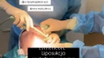 Liposukcja radiofrekwencyjna (liposukcja RF) Centrum Medyczne VENO-MED Jendrysik, Kiełek