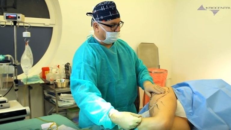 Liposukcja ud (bryczesów) metodą Vaser Lipo