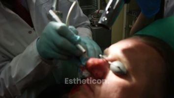 Laserowe leczenie guzowatego rozrostu tkanek nosa - rhinofhyma 